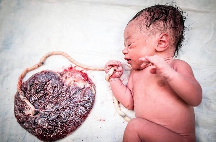 La placenta: il legame madre e bambino