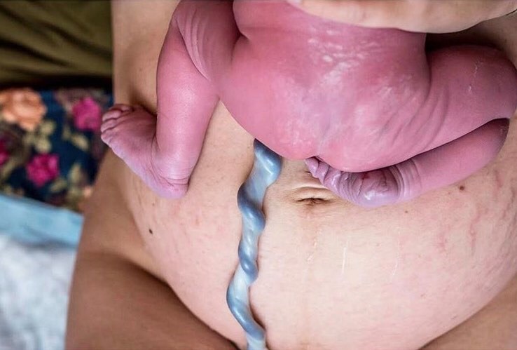 Il legame madre-bambino attraverso il cordone ombelicale